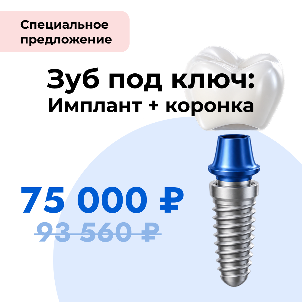 Имплантация зубов