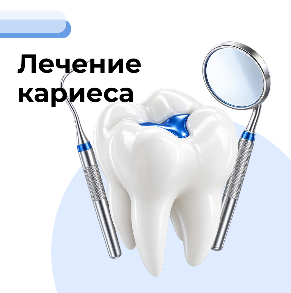 Лечение кариеса